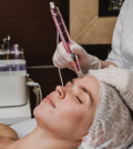 Micro-Needling