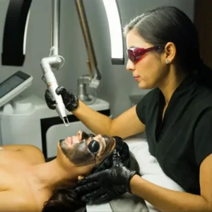 CO2 Laser Treatment